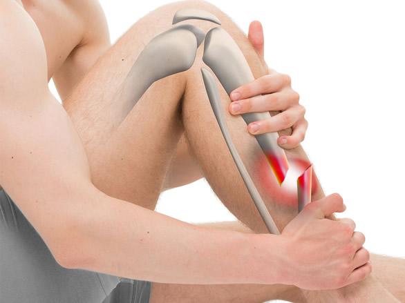 Cirugía de fracturas y lesiones traumatológicas 